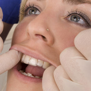 Doctor checking fit of Invisalign tray