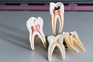 Four models of teeth and root canals